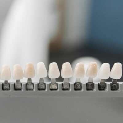 A smiling patient after visiting a trusted cosmetic dentist in Shreveport, showcasing expert dental work and aesthetic results.